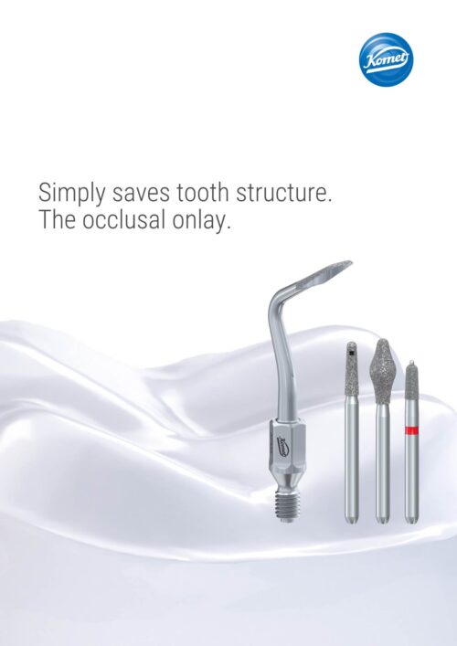 Brochure | occlusal onlays „TableTop”